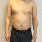 100일줄넘기 챌린지전 몸상태