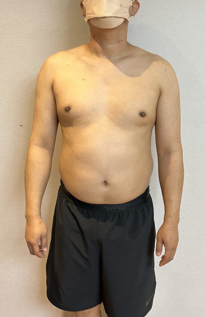 100일줄넘기 챌린지전 몸상태