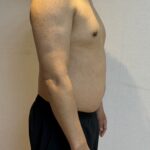 100일줄넘기 챌린지전 몸상태