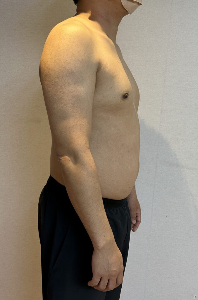 100일줄넘기 챌린지전 몸상태